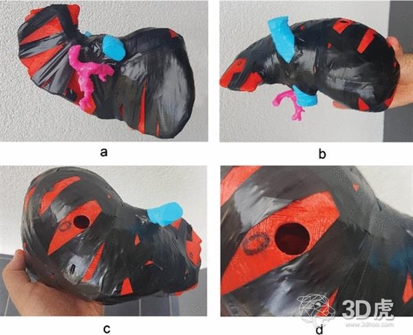 波蘭研究人員借FDM 3D打印機造低成本術前肝臟模型